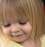 labio leporino labio